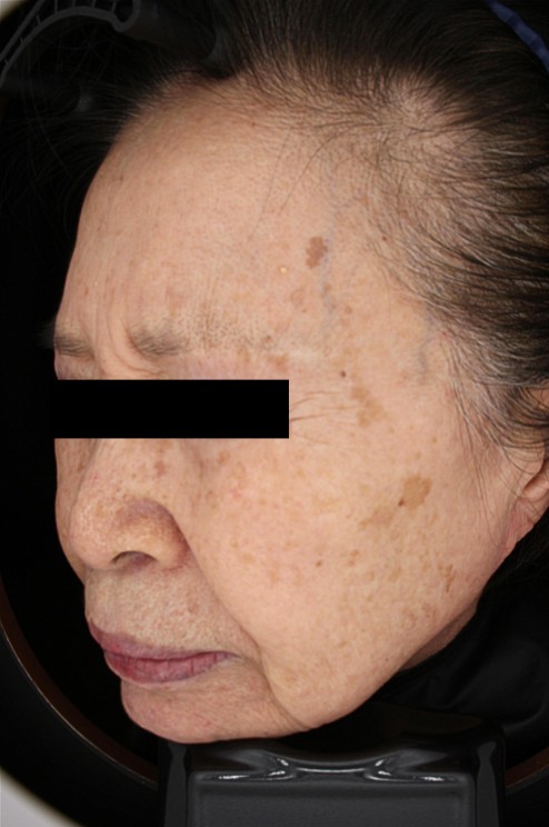 김말연님 25.03 피부톤 Lt.jpg